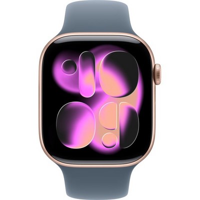 Apple Watch Series 11, 46 mm, Rose Gold Aluminium Anchor Blue Sport Band SM/ML - фото 83311